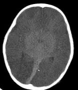 Setembro Verde e a importância de compreender a morte encefálica – Blog ...